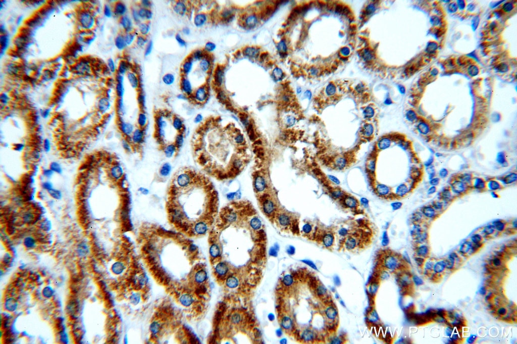 IHC staining of human kidney using 15573-1-AP