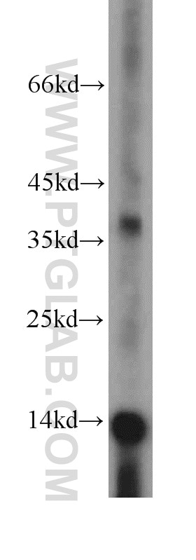 Western Blot (WB) analysis of human liver tissue using NDUFC2 Polyclonal antibody (15573-1-AP)