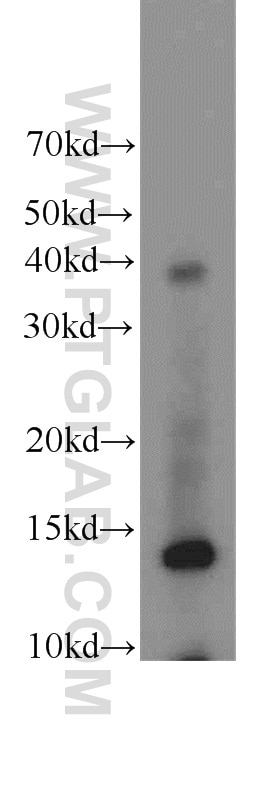 WB analysis of A549 using 15573-1-AP