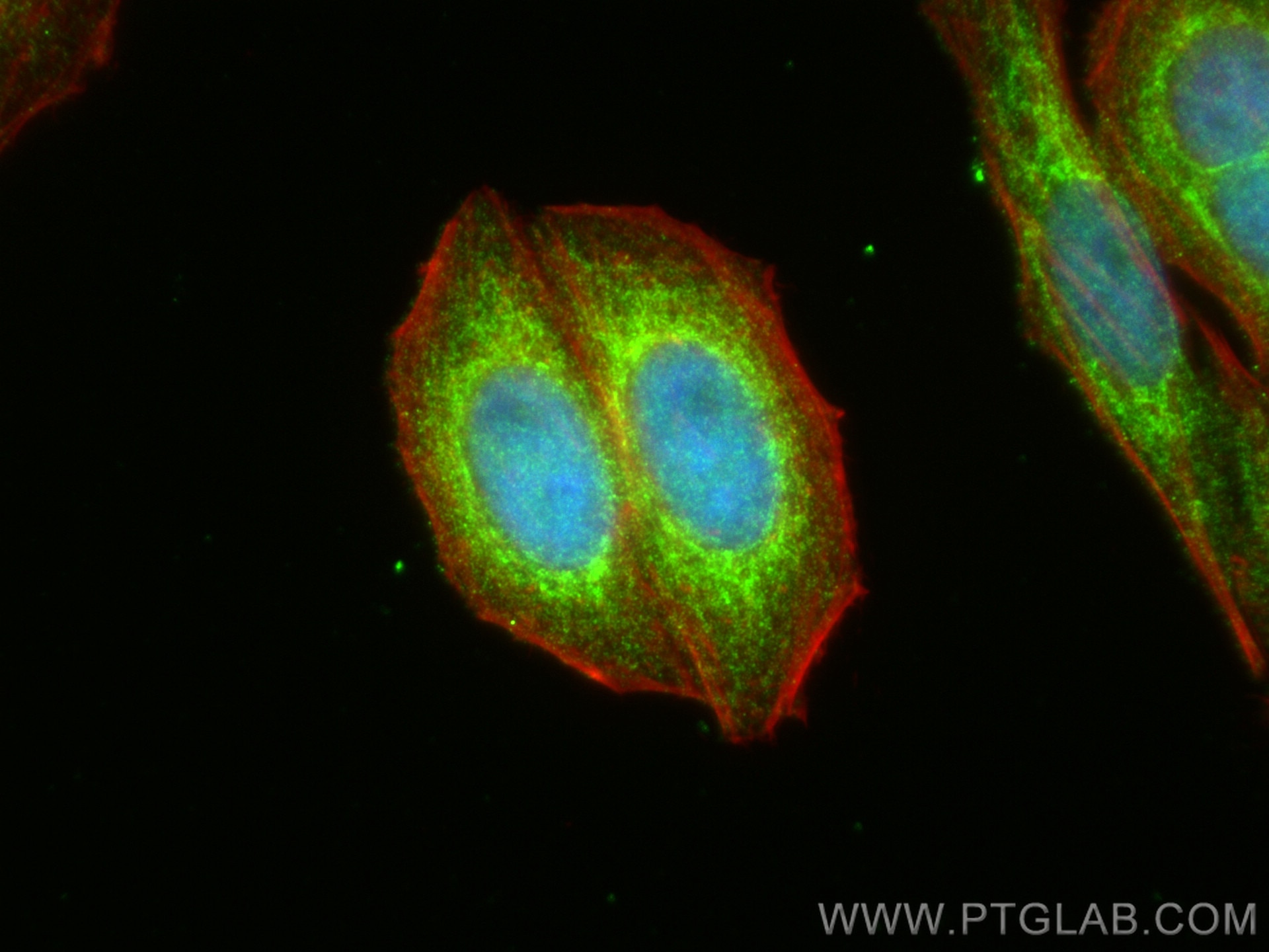 Immunofluorescence (IF) / fluorescent staining of HepG2 cells using NDUFS1 Polyclonal antibody (12444-1-AP)