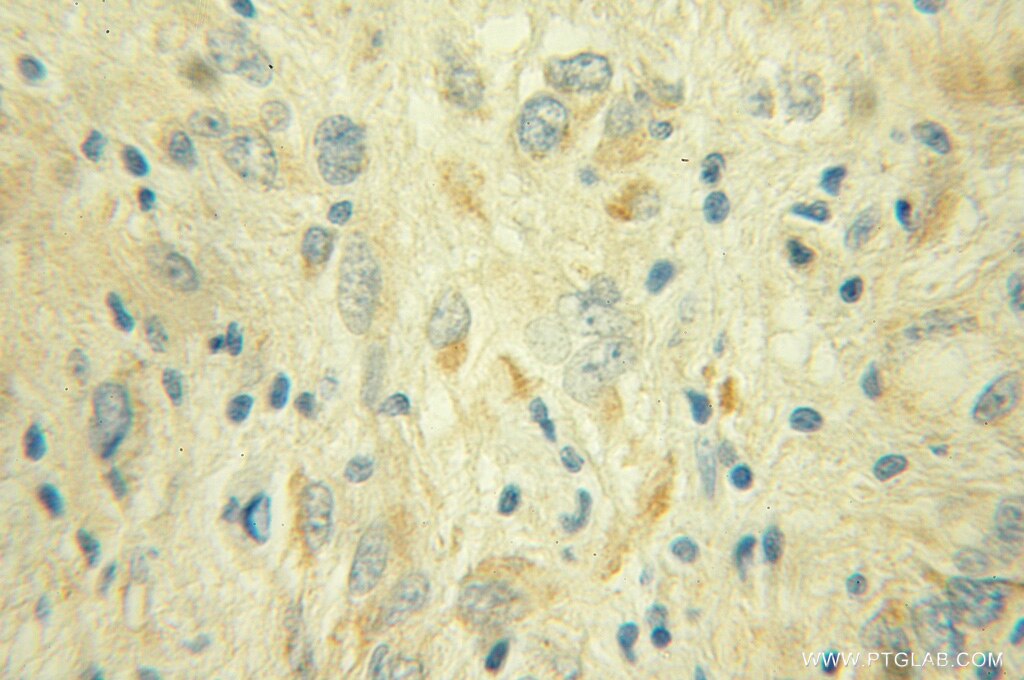 NDUFS1 Polyclonal antibody