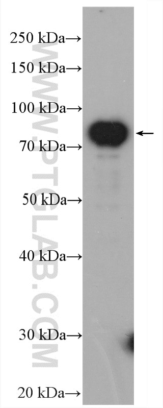 Western Blot (WB) analysis of mouse liver tissue using NDUFS1 Polyclonal antibody (12444-1-AP)