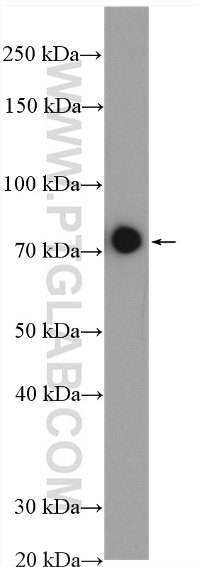 Western Blot (WB) analysis of A549 cells using NDUFS1 Polyclonal antibody (12444-1-PBS)