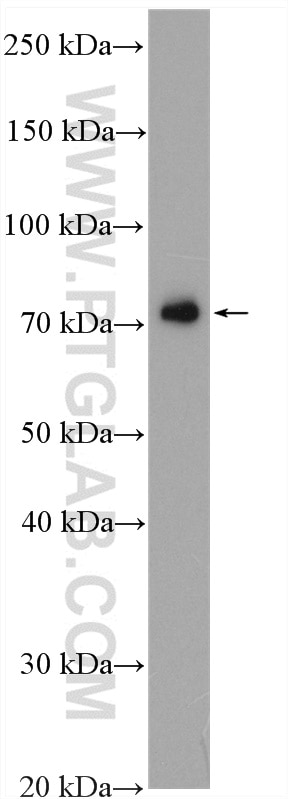 Western Blot (WB) analysis of HEK-293 cells using NDUFS1 Polyclonal antibody (12444-1-AP)
