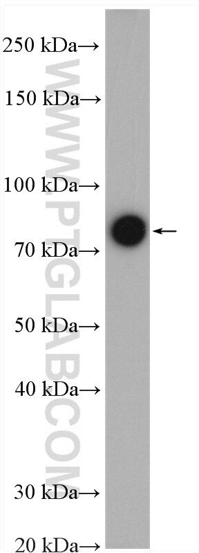 Western Blot (WB) analysis of mouse liver tissue using NDUFS1 Polyclonal antibody (12444-1-PBS)