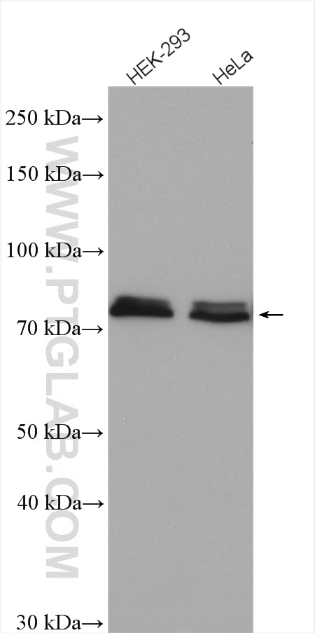 Western Blot (WB) analysis of various lysates using NDUFS1 Polyclonal antibody (12444-1-AP)