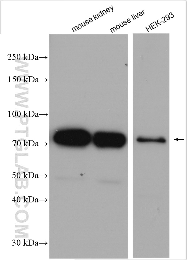 Western Blot (WB) analysis of various lysates using NDUFS1 Polyclonal antibody (12444-1-AP)