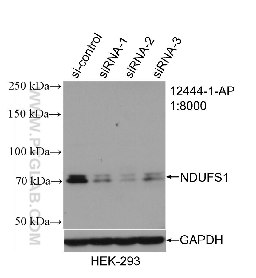 Western Blot (WB) analysis of HEK-293 cells using NDUFS1 Polyclonal antibody (12444-1-AP)