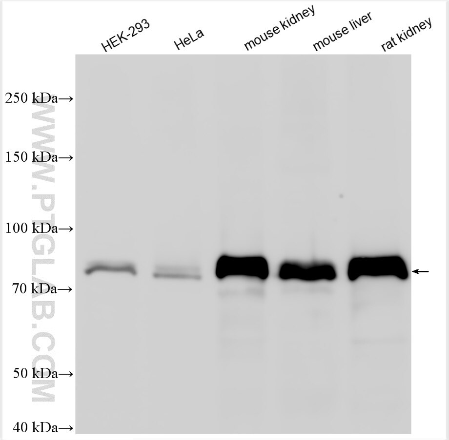 Western Blot (WB) analysis of various lysates using NDUFS1 Polyclonal antibody (12444-1-AP)