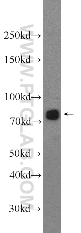 Western Blot (WB) analysis of A549 cells using NDUFS1 Polyclonal antibody (12444-1-AP)