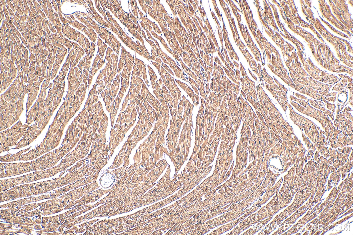 Immunohistochemistry (IHC) staining of mouse heart tissue using NDUFS1 Monoclonal antibody (68253-1-Ig)