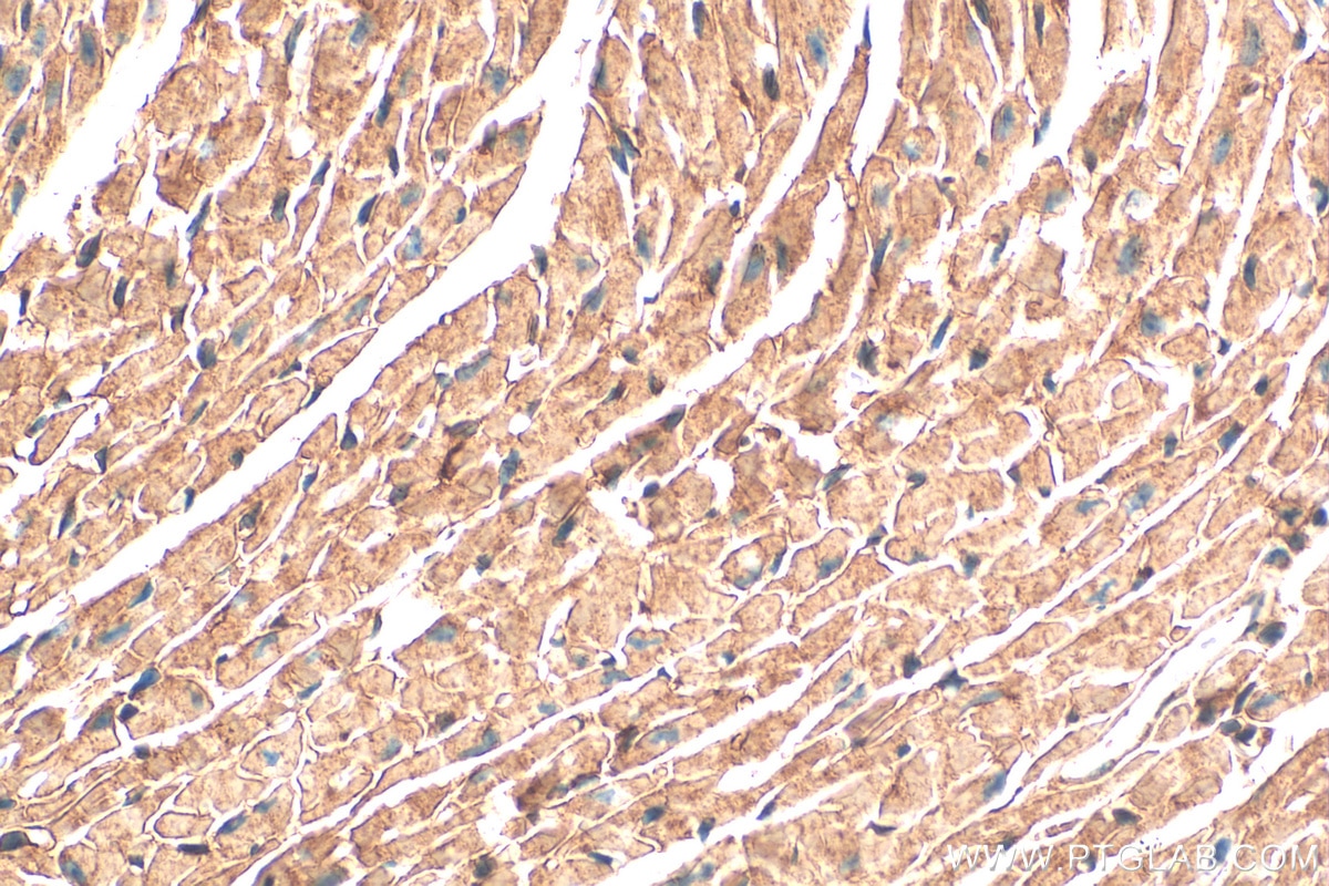 Immunohistochemistry (IHC) staining of mouse heart tissue using NDUFS1 Monoclonal antibody (68253-1-Ig)