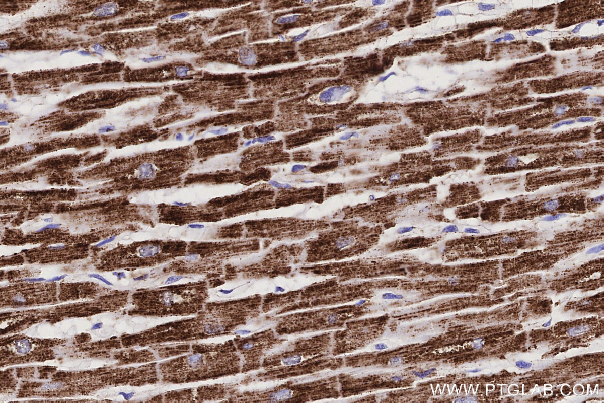 IHC staining of human heart using 68253-1-Ig Immunohistochemistry (IHC) staining of human heart tissue using NDUFS1 Monoclonal antibody (68253-1-Ig)