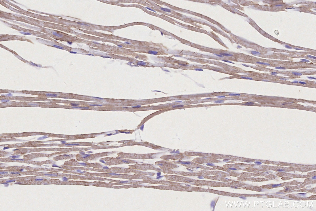 IHC staining of mouse heart using 68253-1-Ig Immunohistochemistry (IHC) staining of mouse heart tissue using NDUFS1 Monoclonal antibody (68253-1-Ig)