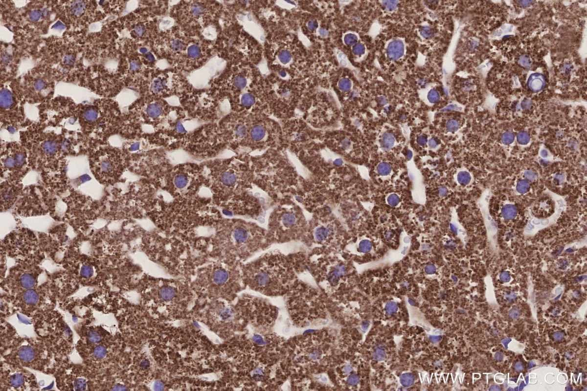 IHC staining of mouse liver using 68253-1-Ig Immunohistochemistry (IHC) staining of mouse liver tissue using NDUFS1 Monoclonal antibody (68253-1-Ig)