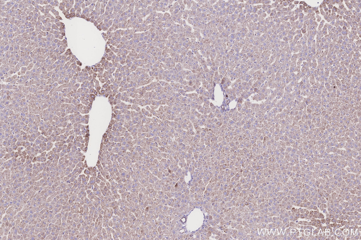 IHC staining of rat liver using 68253-1-Ig Immunohistochemistry (IHC) staining of rat liver tissue using NDUFS1 Monoclonal antibody (68253-1-Ig)
