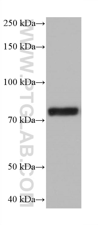 Western Blot (WB) analysis of HeLa cells using NDUFS1 Monoclonal antibody (68253-1-Ig)
