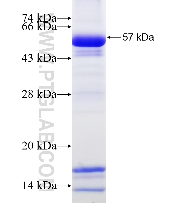 NDUFS1 fusion protein Ag3135 SDS-PAGE