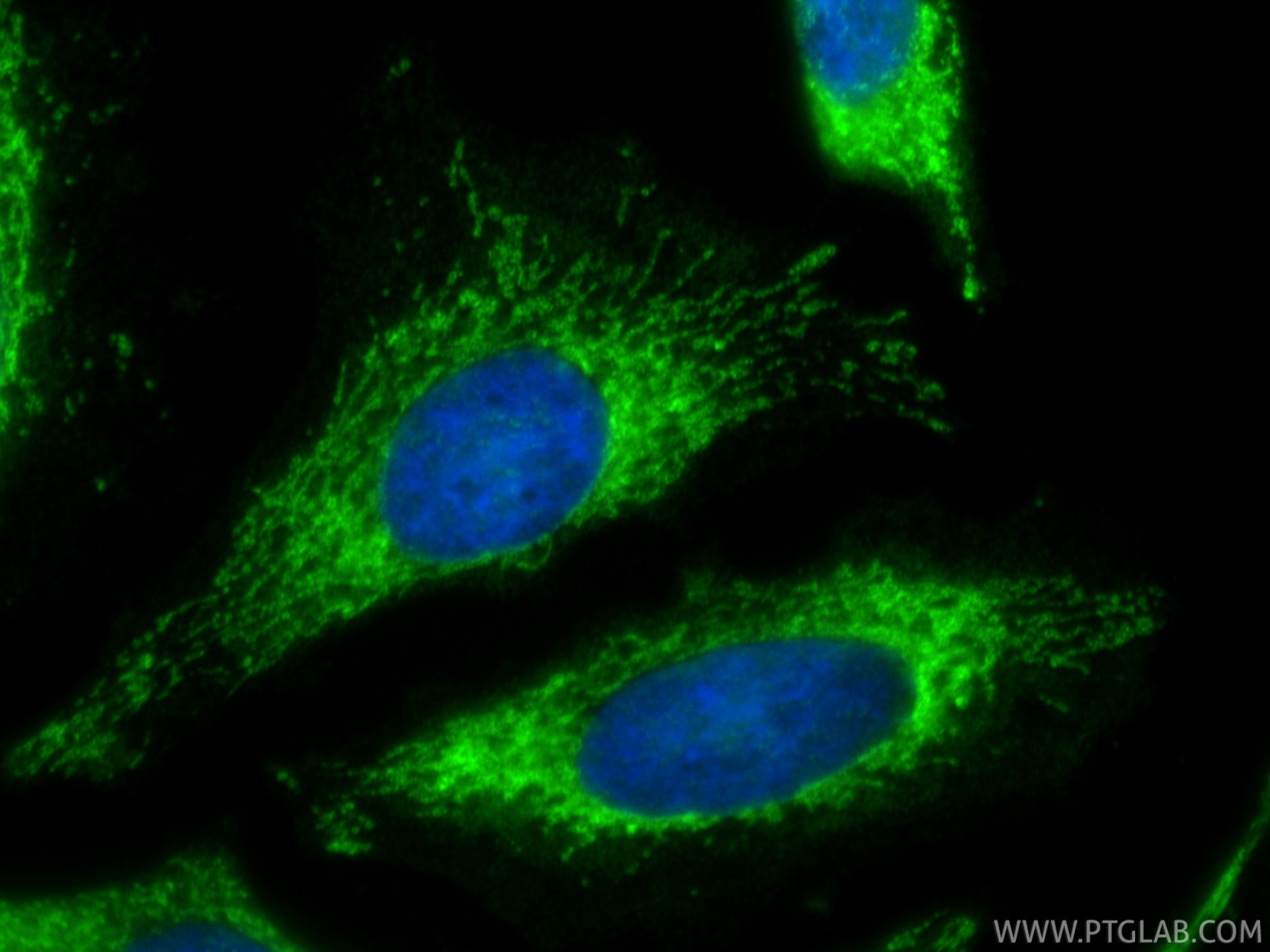 Immunofluorescence (IF) / fluorescent staining of HeLa cells using NDUFS2 Polyclonal antibody (28125-1-AP)