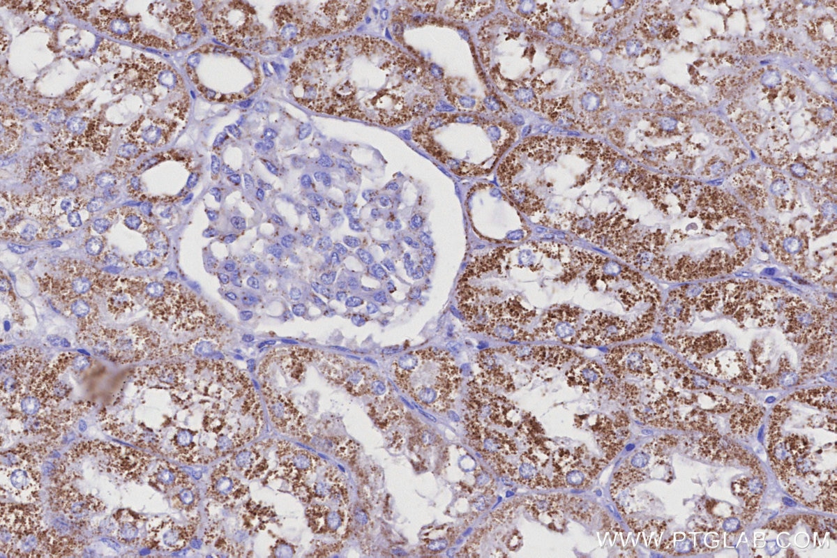 IHC staining of human kidney using 28125-1-AP Immunohistochemistry (IHC) staining of human kidney tissue using NDUFS2 Polyclonal antibody (28125-1-AP)
