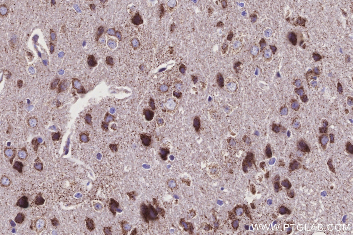 IHC staining of mouse brain using 28125-1-AP Immunohistochemistry (IHC) staining of mouse brain tissue using NDUFS2 Polyclonal antibody (28125-1-AP)