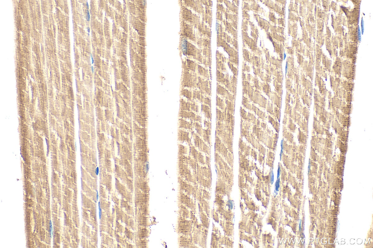 Immunohistochemistry (IHC) staining of mouse skeletal muscle tissue using NDUFS2 Polyclonal antibody (28125-1-AP)