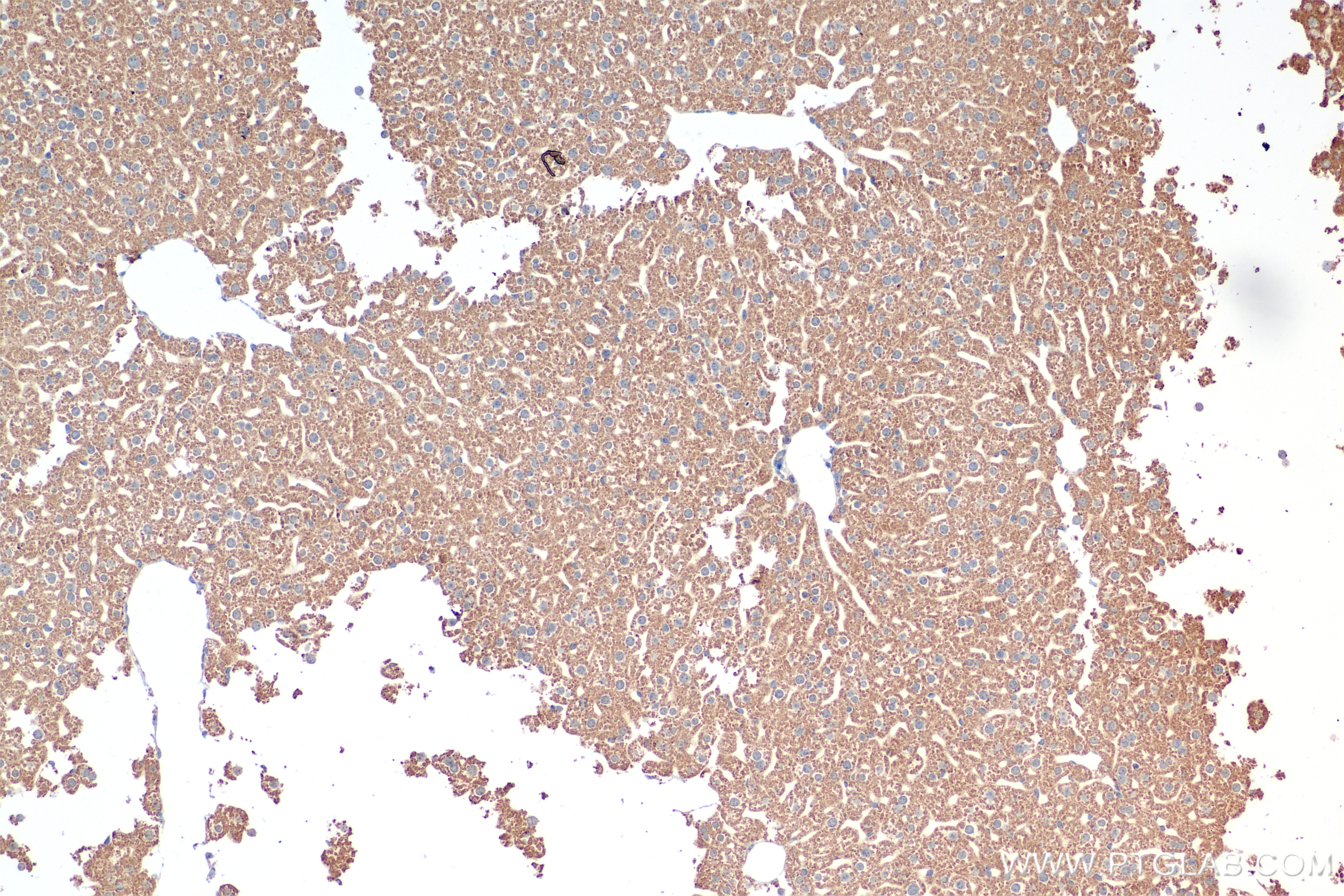 Immunohistochemistry (IHC) staining of mouse liver tissue using NDUFS2 Recombinant antibody (84880-1-RR)