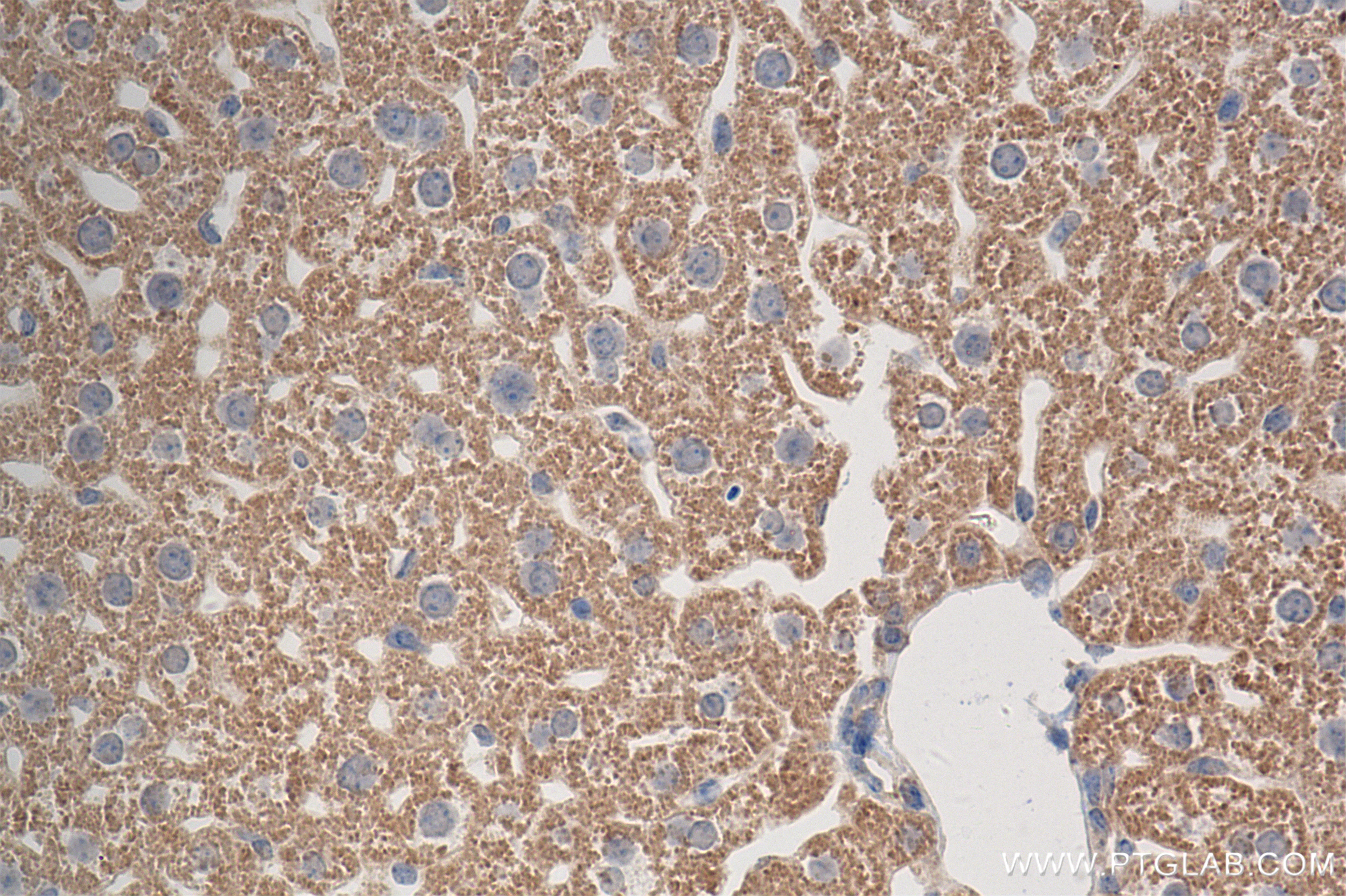 Immunohistochemistry (IHC) staining of mouse liver tissue using NDUFS2 Recombinant antibody (84880-1-RR)