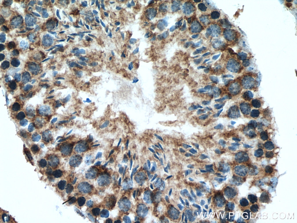 Immunohistochemistry (IHC) staining of mouse testis tissue using NDUFS3 Polyclonal antibody (15066-1-AP)