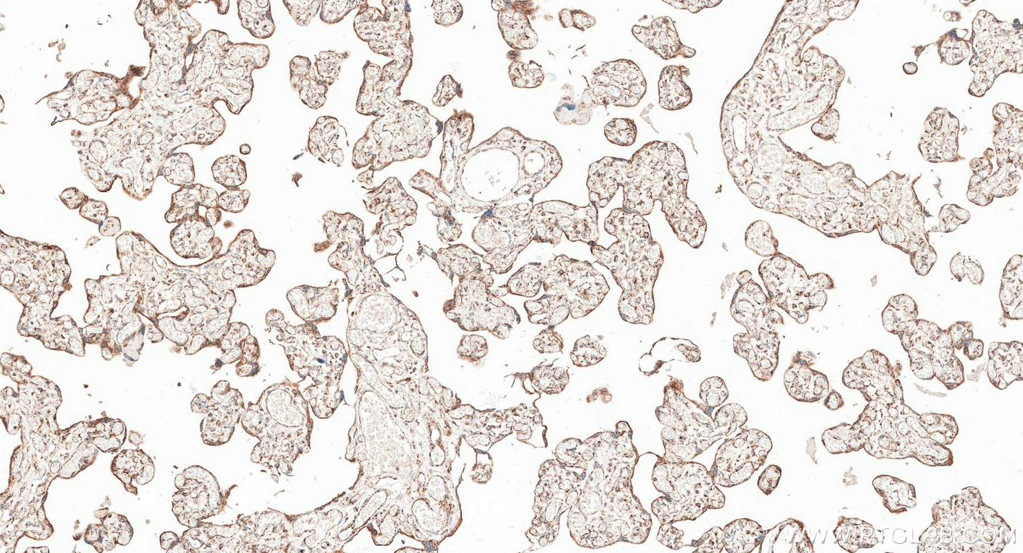 Immunohistochemistry (IHC) staining of human placenta tissue using Multi-rAb® NDUFS3 Multi-Recombinant antibody (RMX00096)