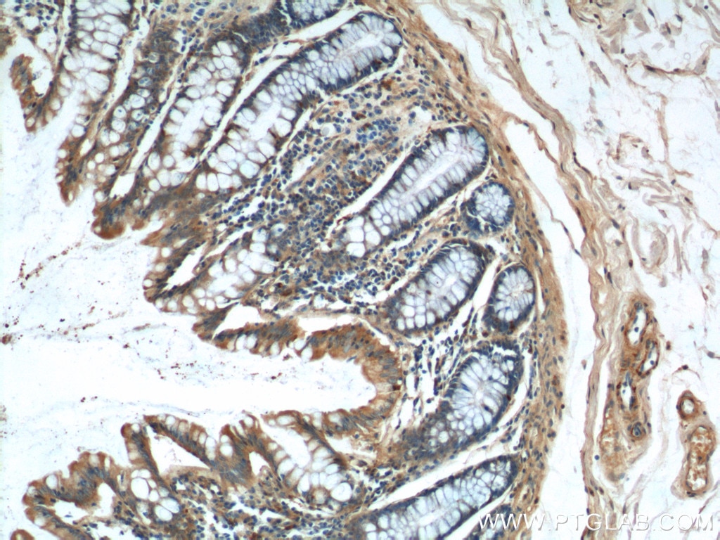 Immunohistochemistry (IHC) staining of human colon tissue using NDUFS4 Polyclonal antibody (15849-1-AP)
