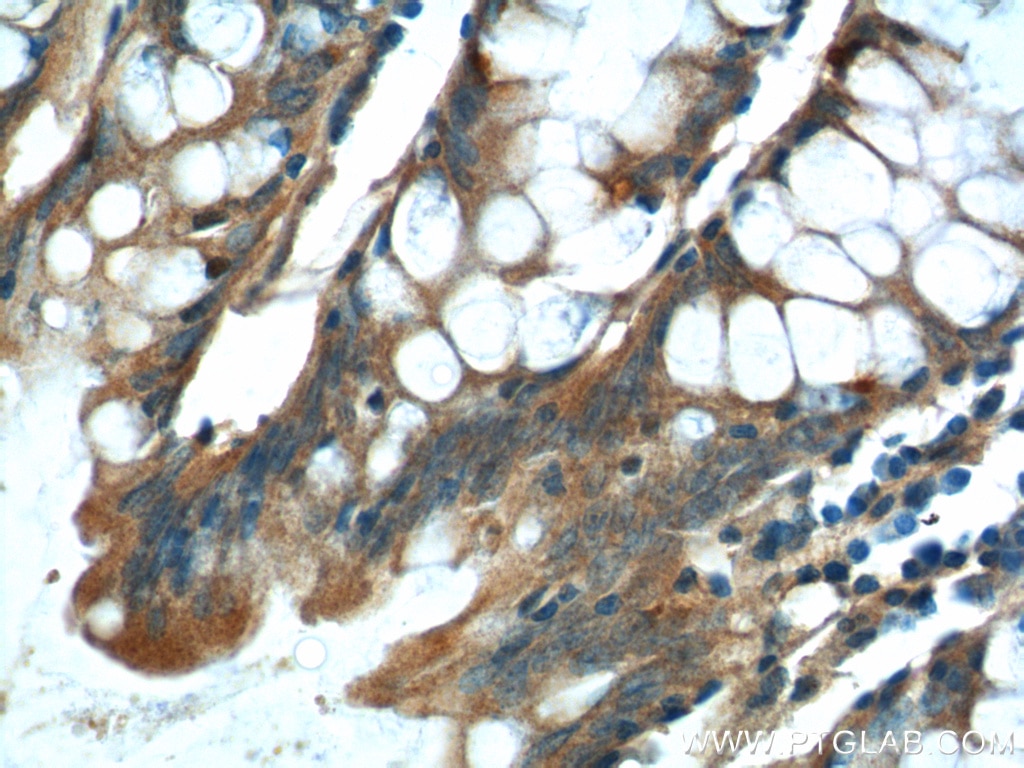 Immunohistochemistry (IHC) staining of human colon tissue using NDUFS4 Polyclonal antibody (15849-1-AP)