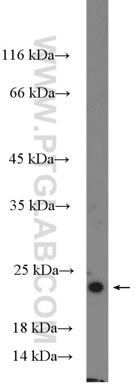 Western Blot (WB) analysis of rat heart tissue using NDUFS4 Polyclonal antibody (15849-1-AP)