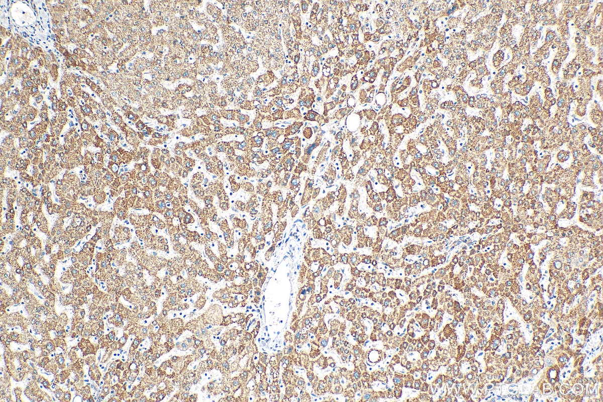 IHC staining of human liver using 15224-1-AP
