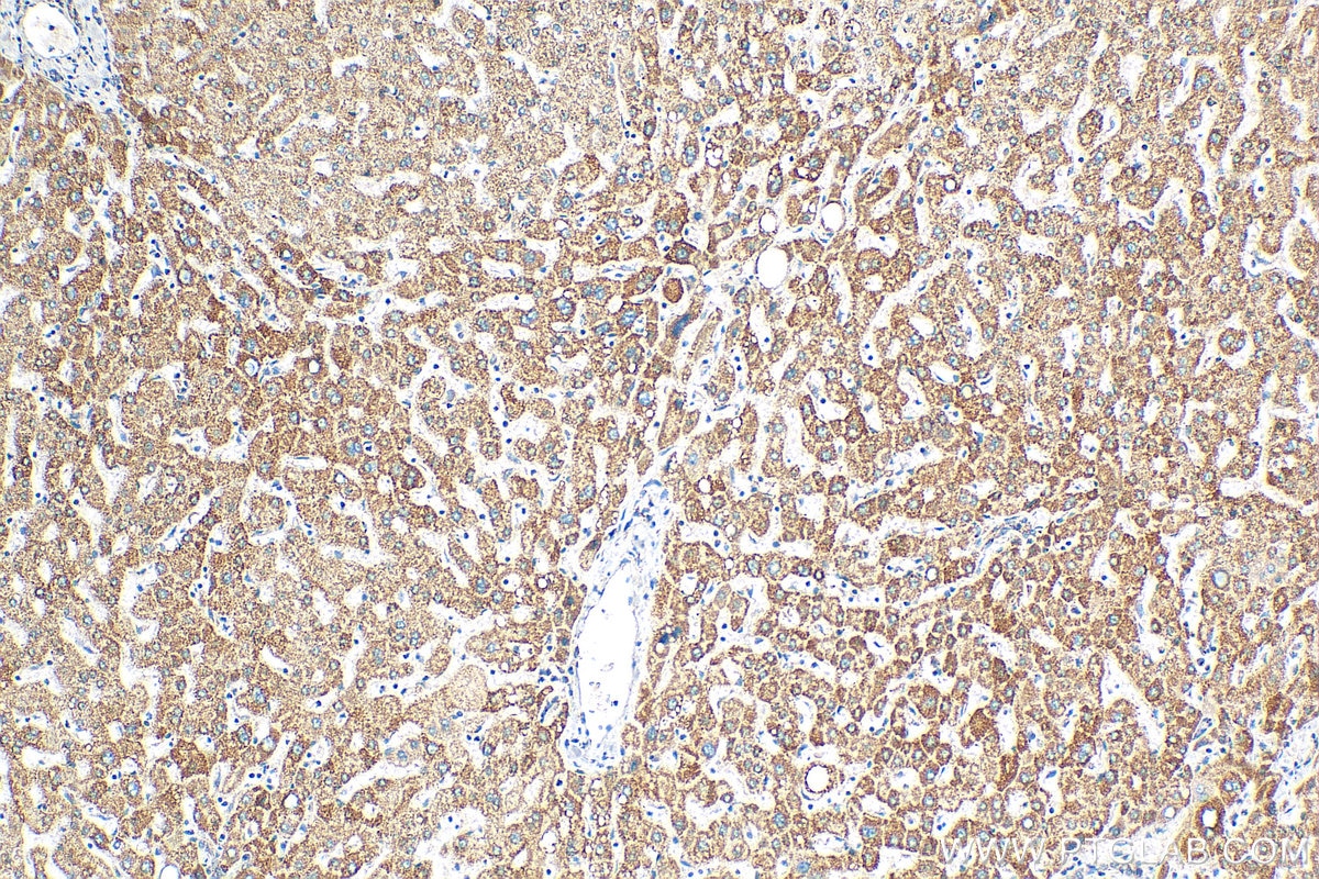 Immunohistochemistry (IHC) staining of human liver tissue using NDUFS5 Polyclonal antibody (15224-1-AP)