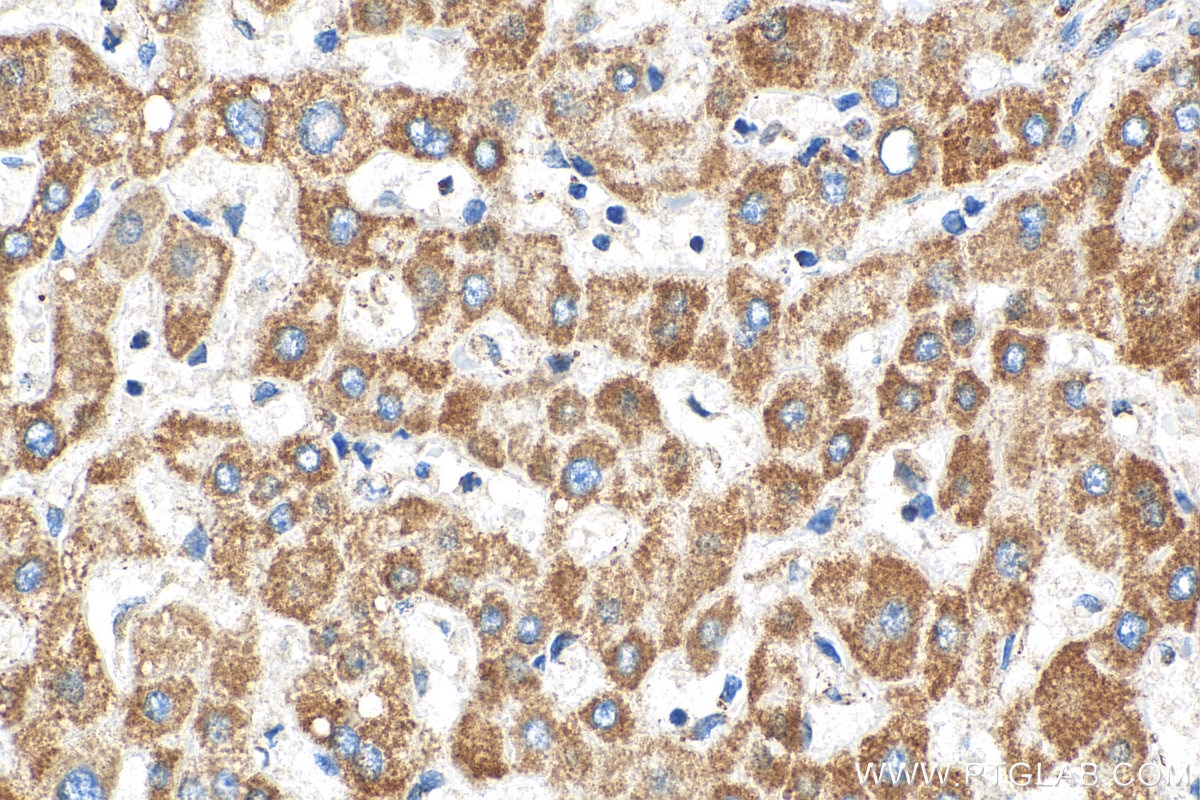 Immunohistochemistry (IHC) staining of human liver tissue using NDUFS5 Polyclonal antibody (15224-1-AP)