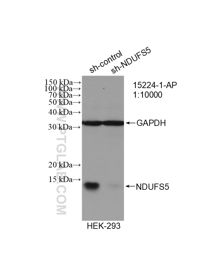 Western Blot (WB) analysis of HEK-293 cells using NDUFS5 Polyclonal antibody (15224-1-AP)