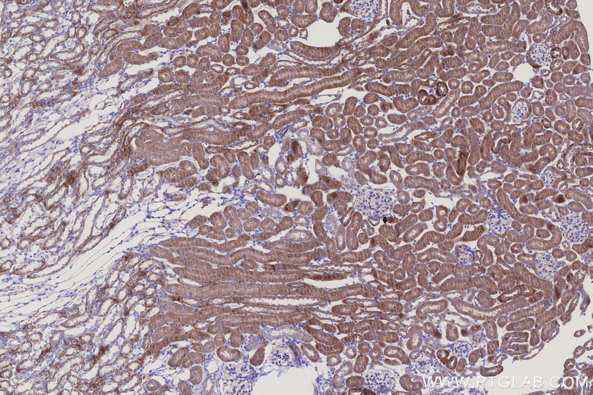 Immunohistochemistry (IHC) staining of mouse kidney tissue using NDUFS5 Monoclonal antibody (66053-1-Ig)