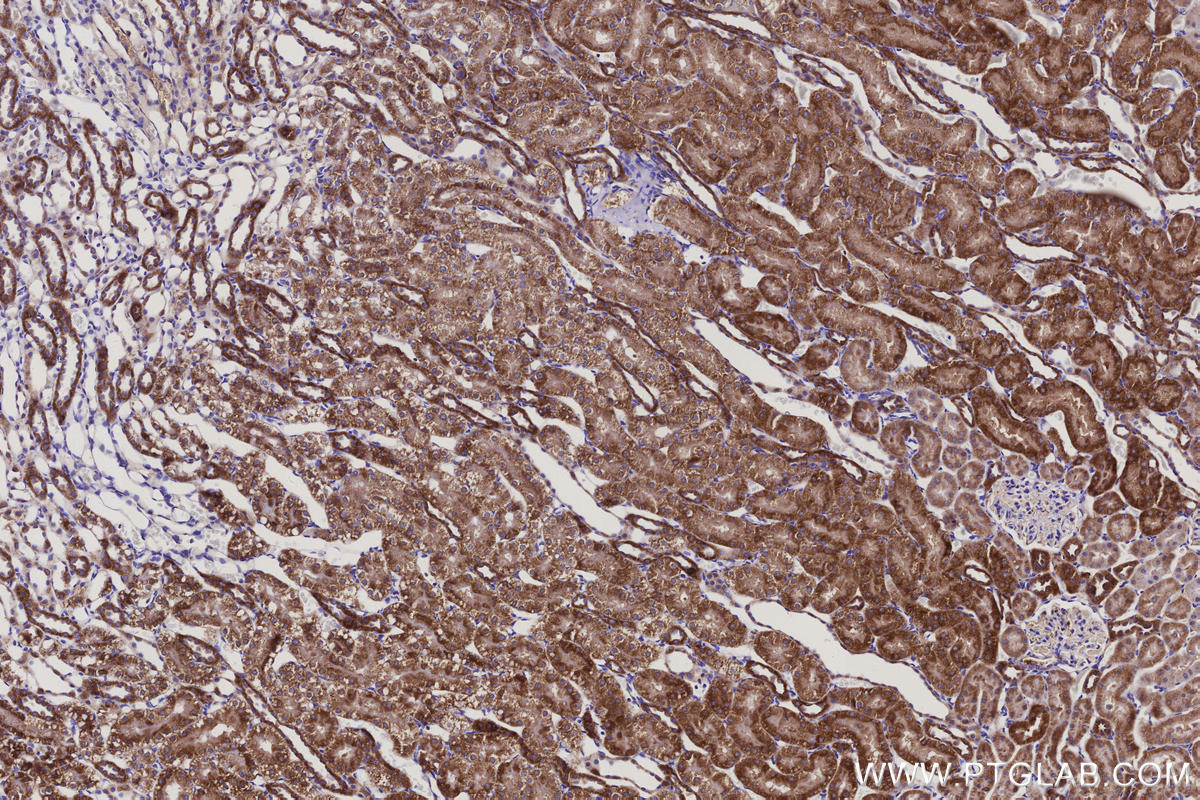 Immunohistochemistry (IHC) staining of rat kidney tissue using NDUFS5 Monoclonal antibody (66053-1-Ig)