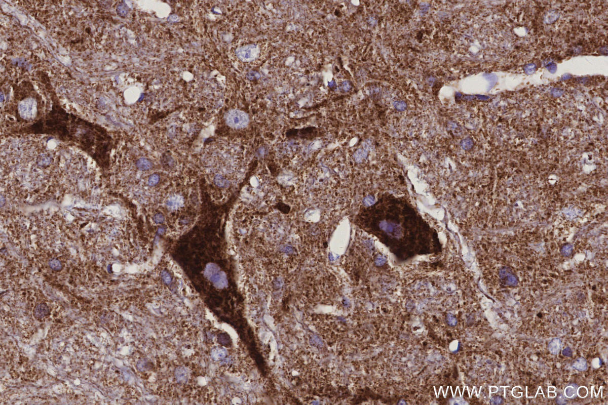 Immunohistochemistry (IHC) staining of rat cerebellum tissue using NDUFS5 Monoclonal antibody (66053-1-Ig)