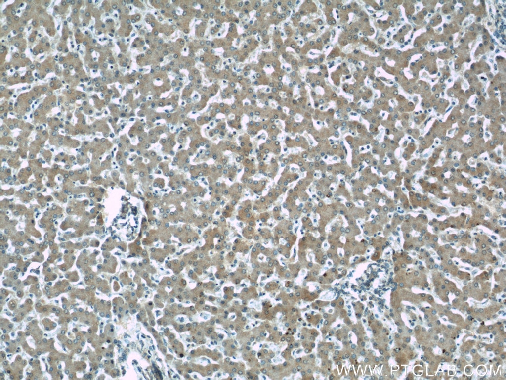 Immunohistochemistry (IHC) staining of human liver tissue using NDUFS5 Monoclonal antibody (66053-1-Ig)