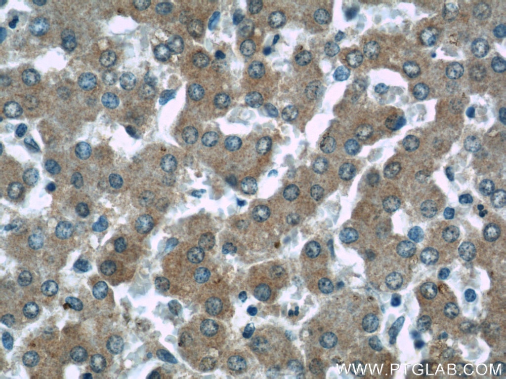 Immunohistochemistry (IHC) staining of human liver tissue using NDUFS5 Monoclonal antibody (66053-1-Ig)