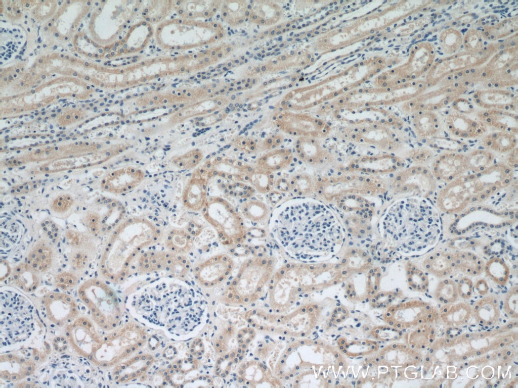 Immunohistochemistry (IHC) staining of human kidney tissue using NDUFS5 Monoclonal antibody (66053-1-Ig)
