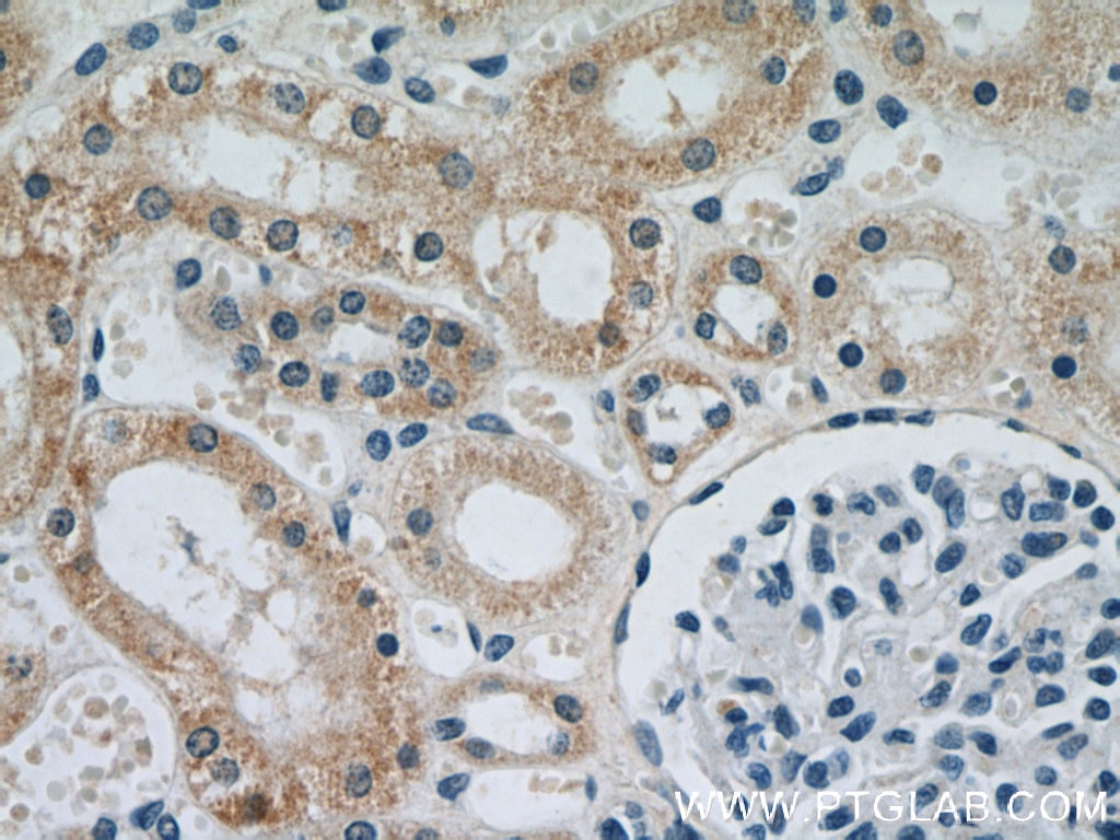 Immunohistochemistry (IHC) staining of human kidney tissue using NDUFS5 Monoclonal antibody (66053-1-Ig)