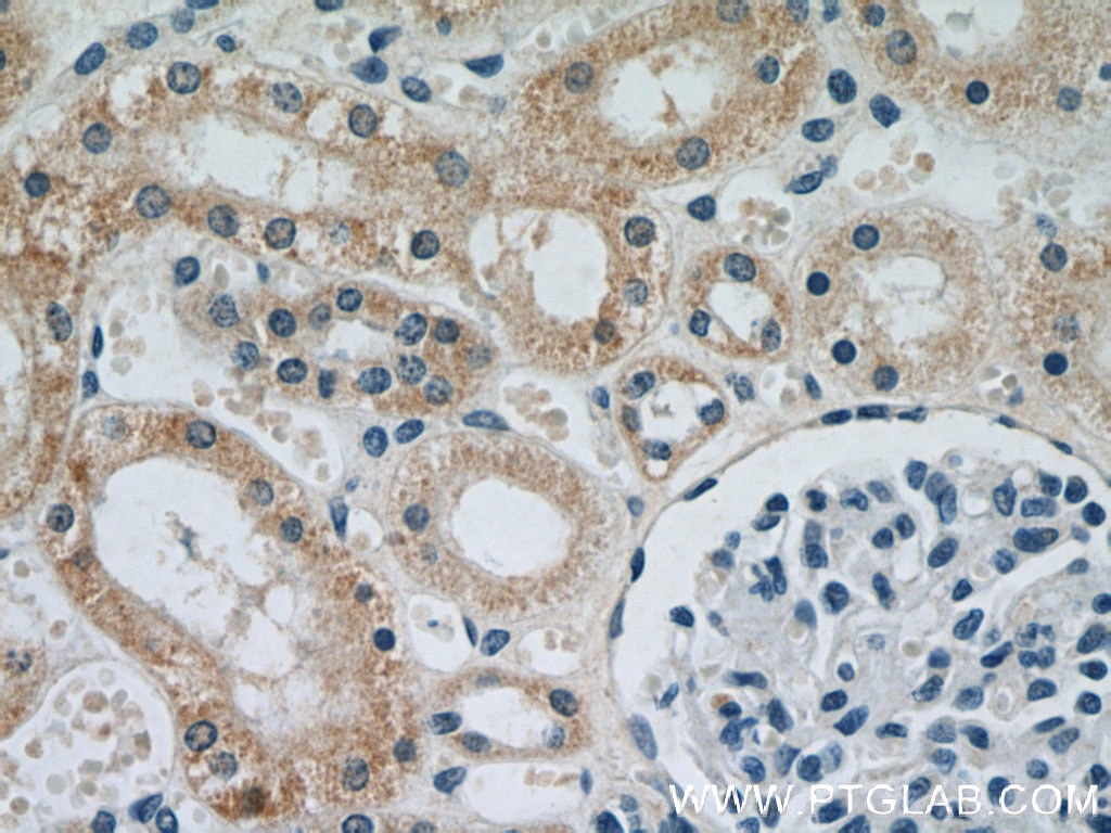 IHC staining of human kidney using 66053-1-Ig