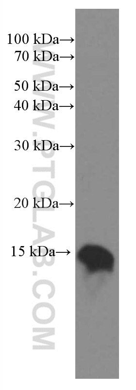 Western Blot (WB) analysis of fetal human brain tissue using NDUFS5 Monoclonal antibody (66053-1-Ig)