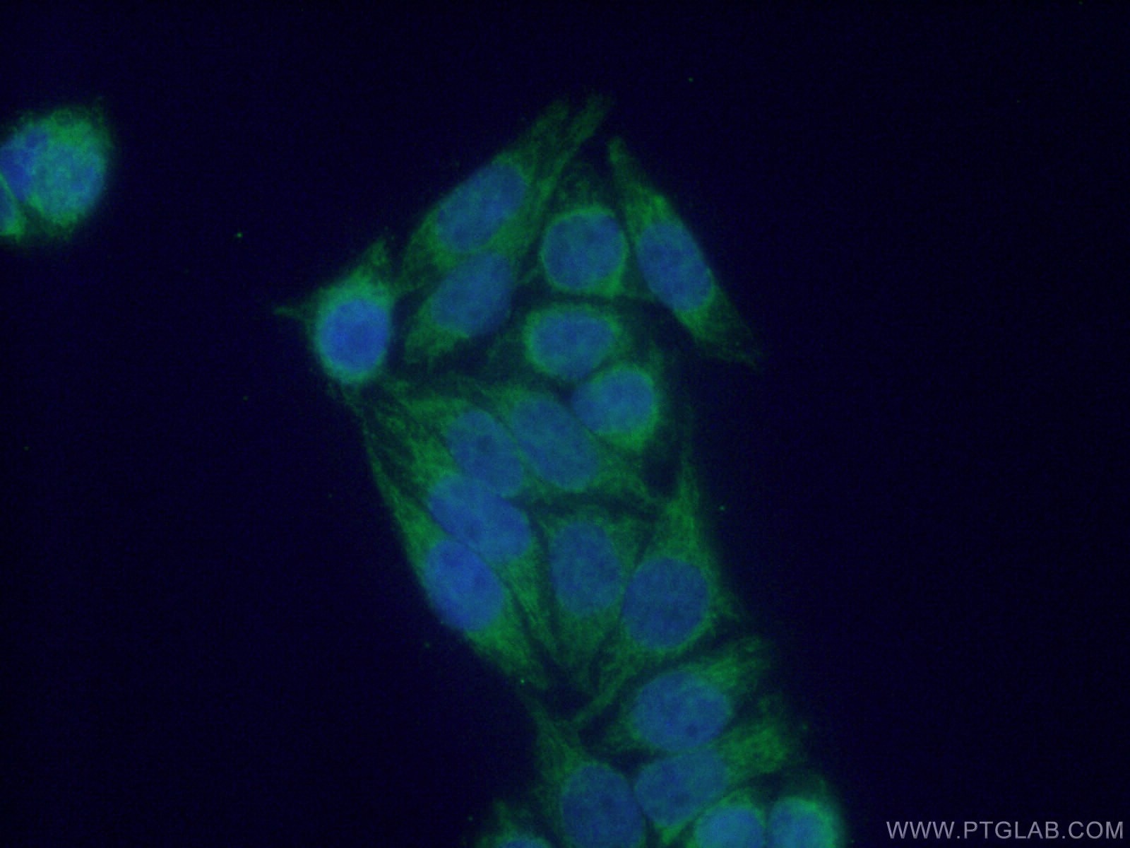 Immunofluorescence (IF) / fluorescent staining of HeLa cells using NDUFS6 Polyclonal antibody (14417-1-AP)