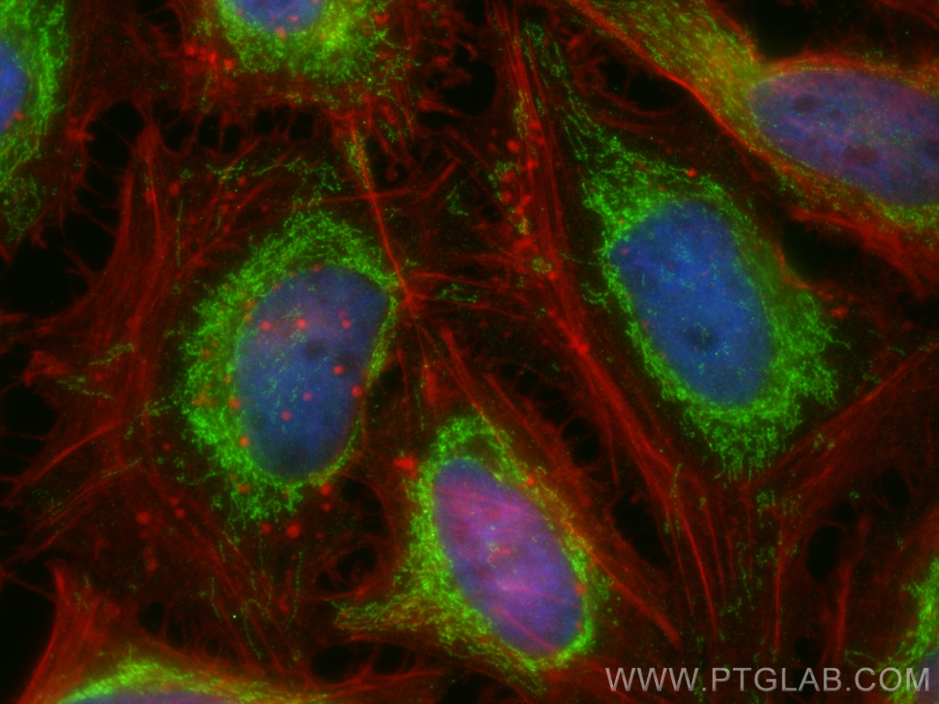 Immunofluorescence (IF) / fluorescent staining of HeLa cells using NDUFS6 Polyclonal antibody (14417-1-AP)