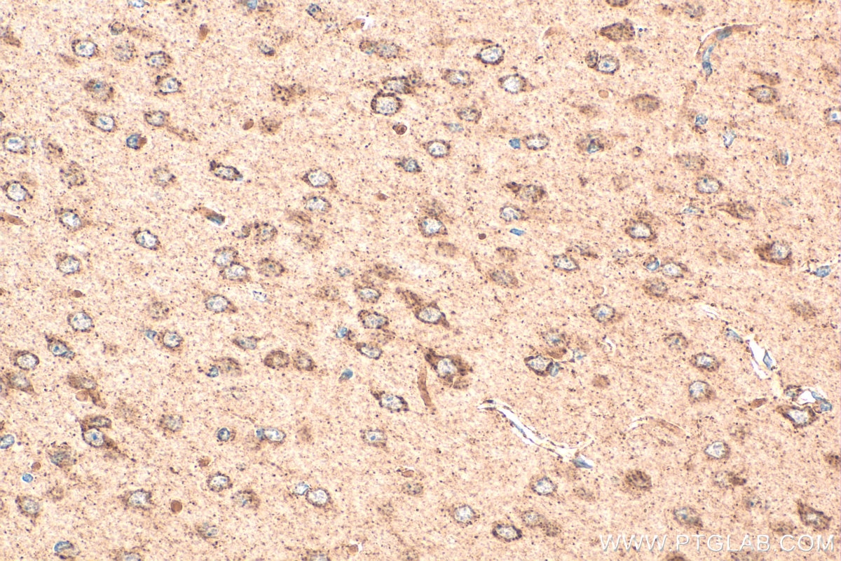 Immunohistochemistry (IHC) staining of mouse brain tissue using NDUFS6 Polyclonal antibody (14417-1-AP)