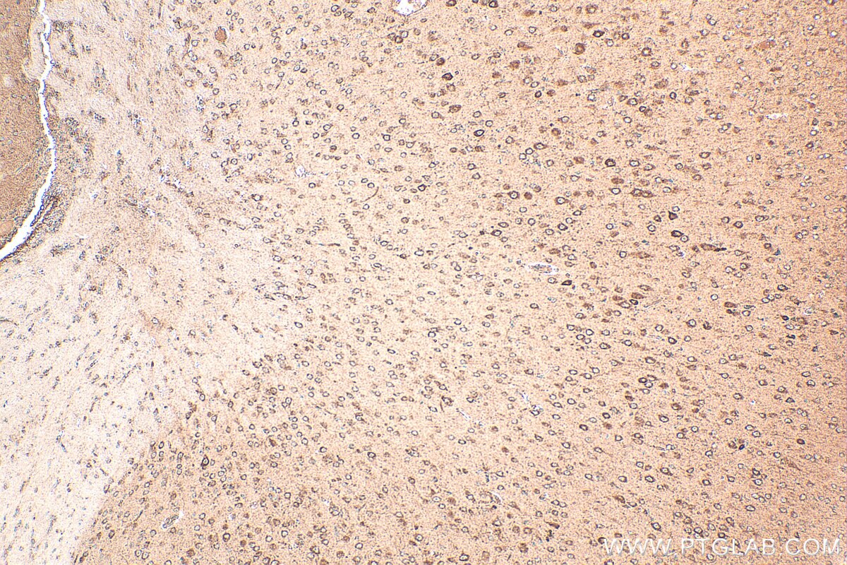 Immunohistochemistry (IHC) staining of mouse brain tissue using NDUFS6 Polyclonal antibody (14417-1-AP)